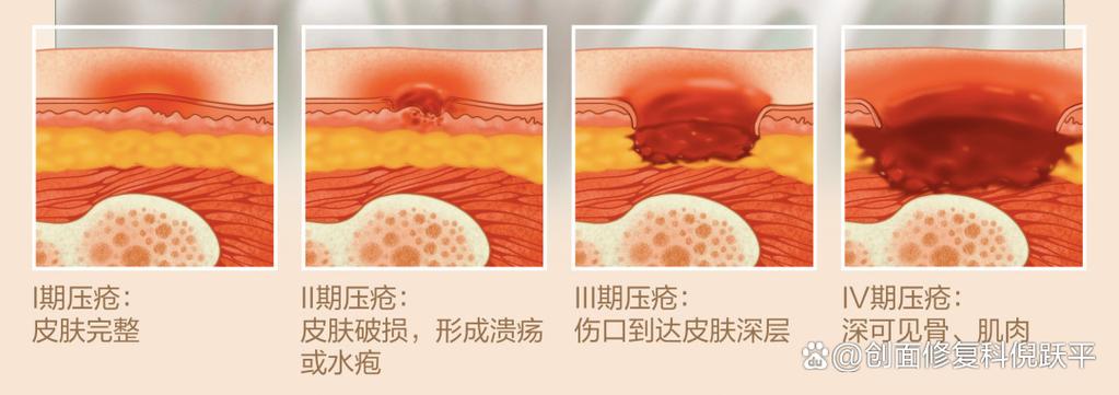 机器人历险记攻略：全方位通关指南